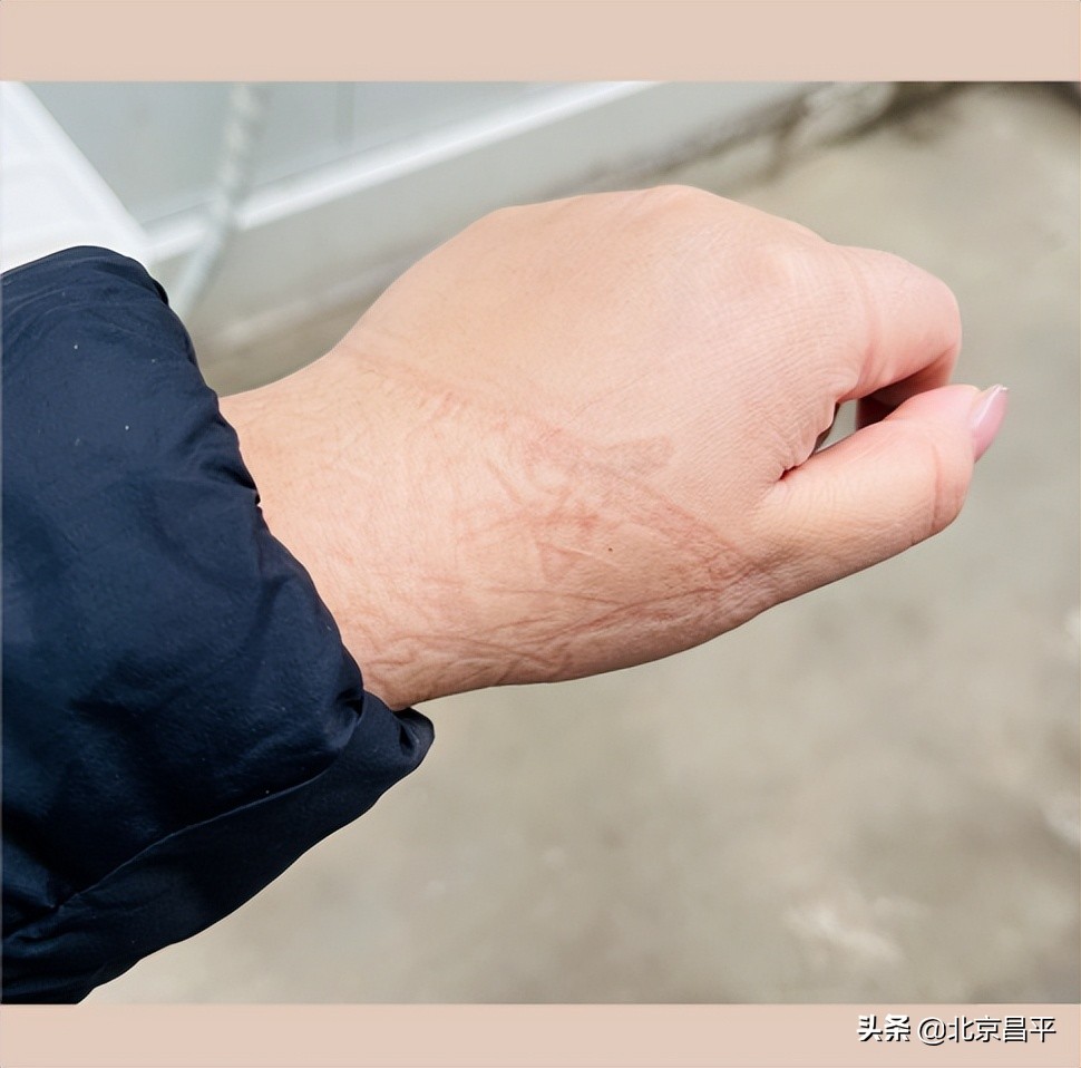 这些“双向奔赴”瞬间，温暖了昌平抗“疫”一线