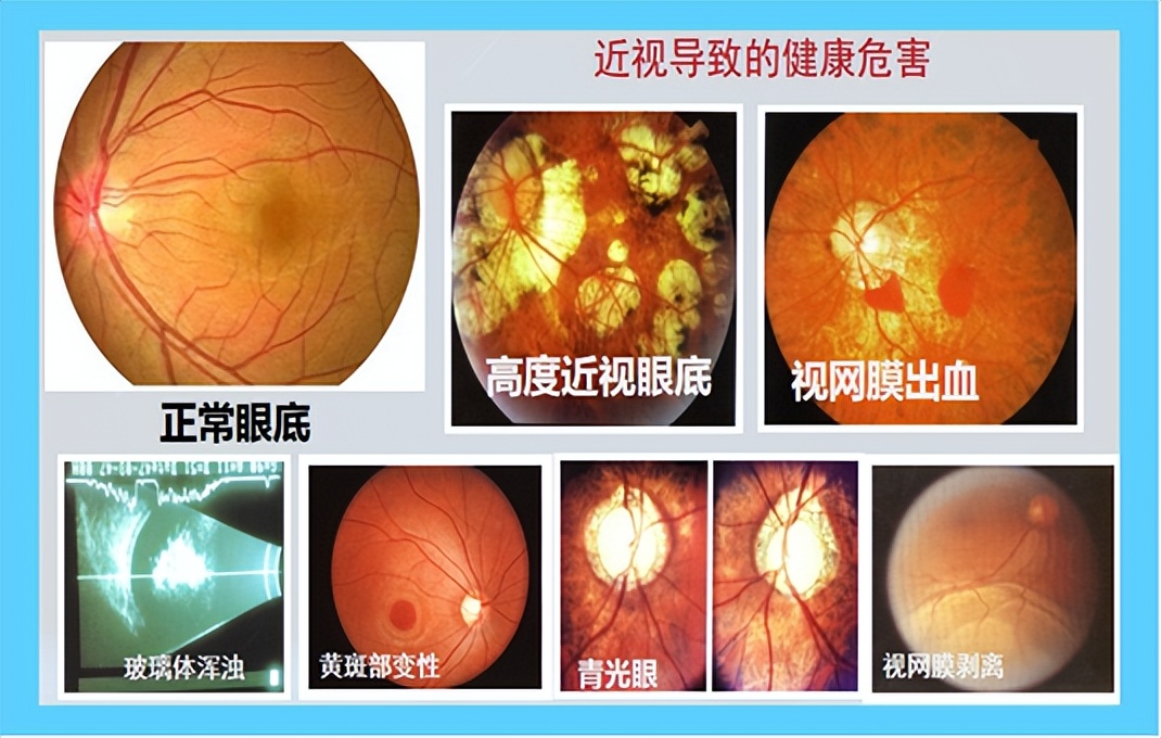 看见爱·守护EYE——爱眼日公益联合义诊活动