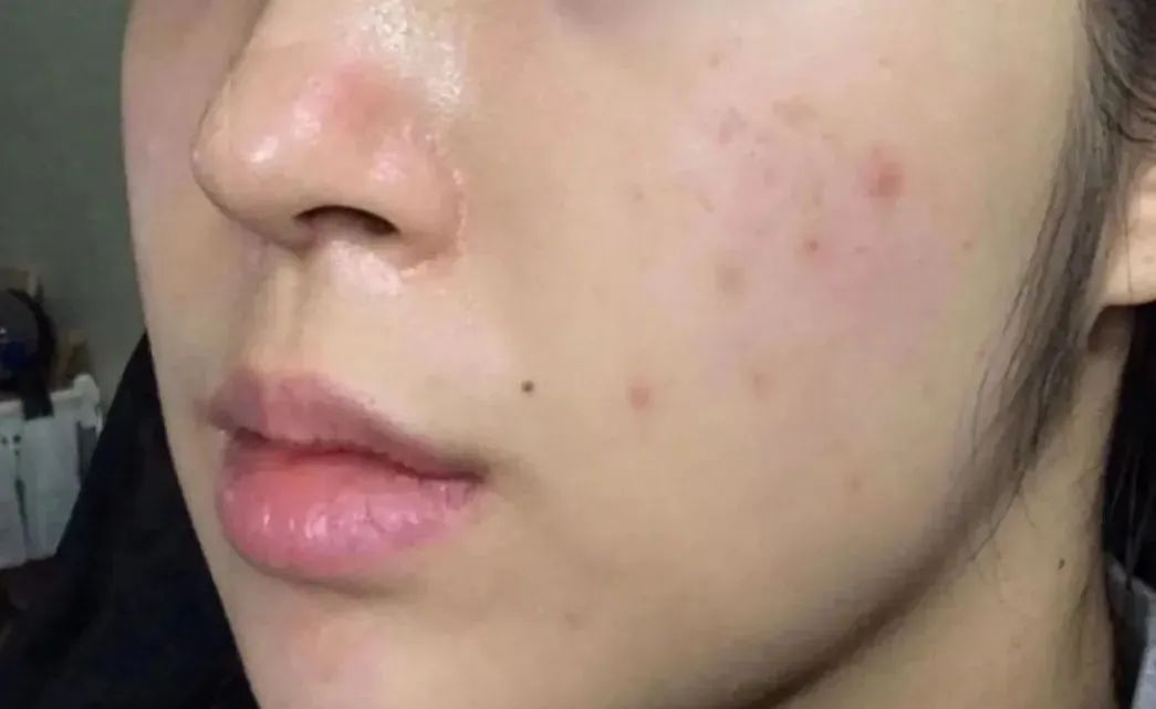 为一线大白送上一份护肤“秘籍”